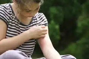 Top Tips to Help Comfort Your Child After Bug Bites and Itchiness