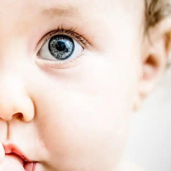 The Symptoms & Treatment of Eyelid Problems in Babies