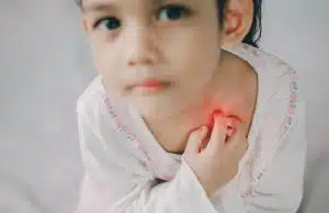 Ringworm: Treatment & Prevention