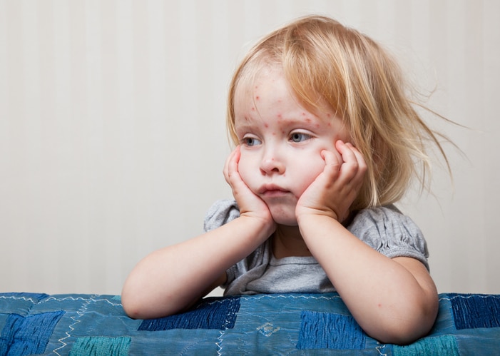 Common Skin Problems in Children