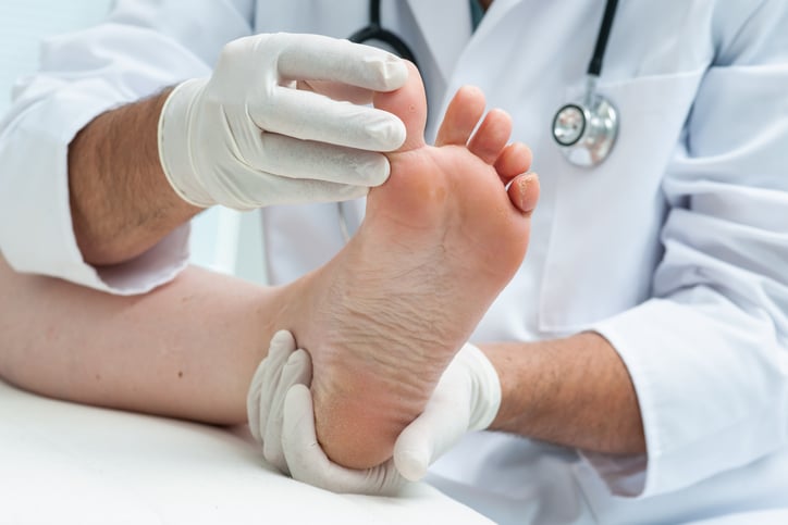 Athlete's Foot in Children