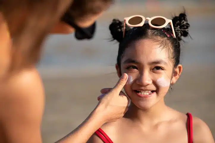 Sunburn Treatment