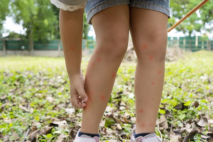 Lyme Disease