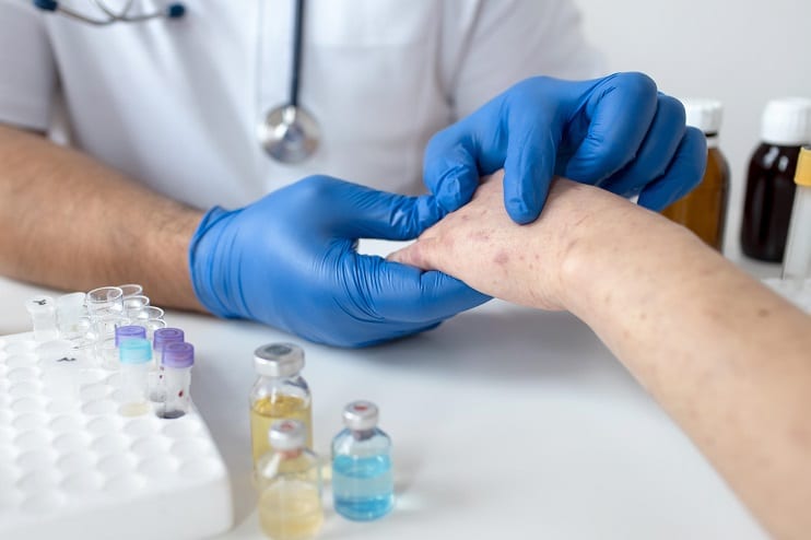 Anaphylaxis in Children